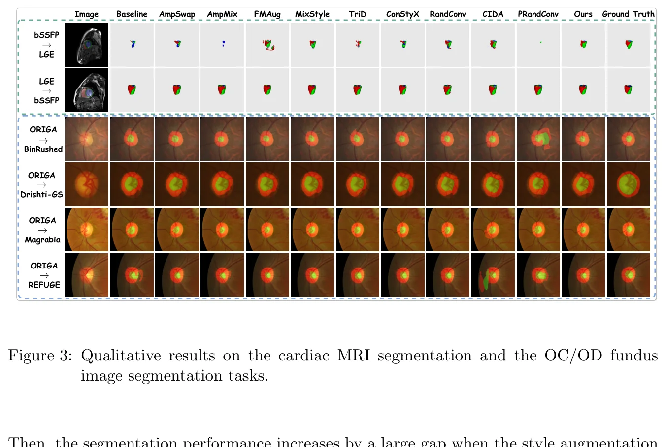 图 3：定性分割结果对比。图源：Shen et al., Figure 3, PMLR 2025